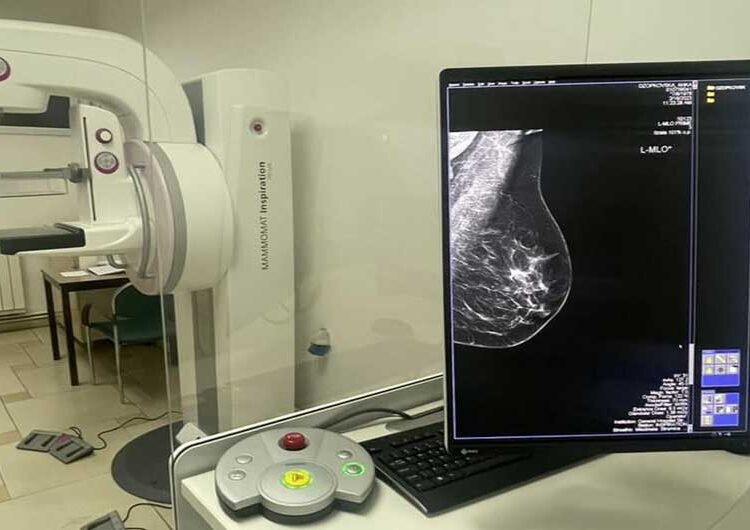 Во струмичката болница обезбедени нов дигитален Мамограф и модерен Ултразвук за ехо на дојка
