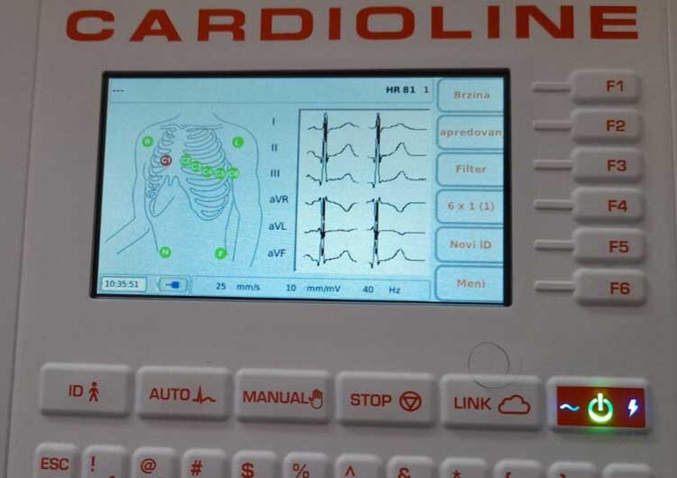 Преку Донаторска акција обезбедена медицинска опрема за Кардиологија во струмичката болница